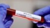 Según cifras de la Organización Mundial de la Salud (OMS), el coronavirus ha golpeado a más de 130 países.