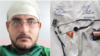 El doctor Pupo Casas publicó en Facebook una foto de sus accesorios para ejercer la Medicina.
